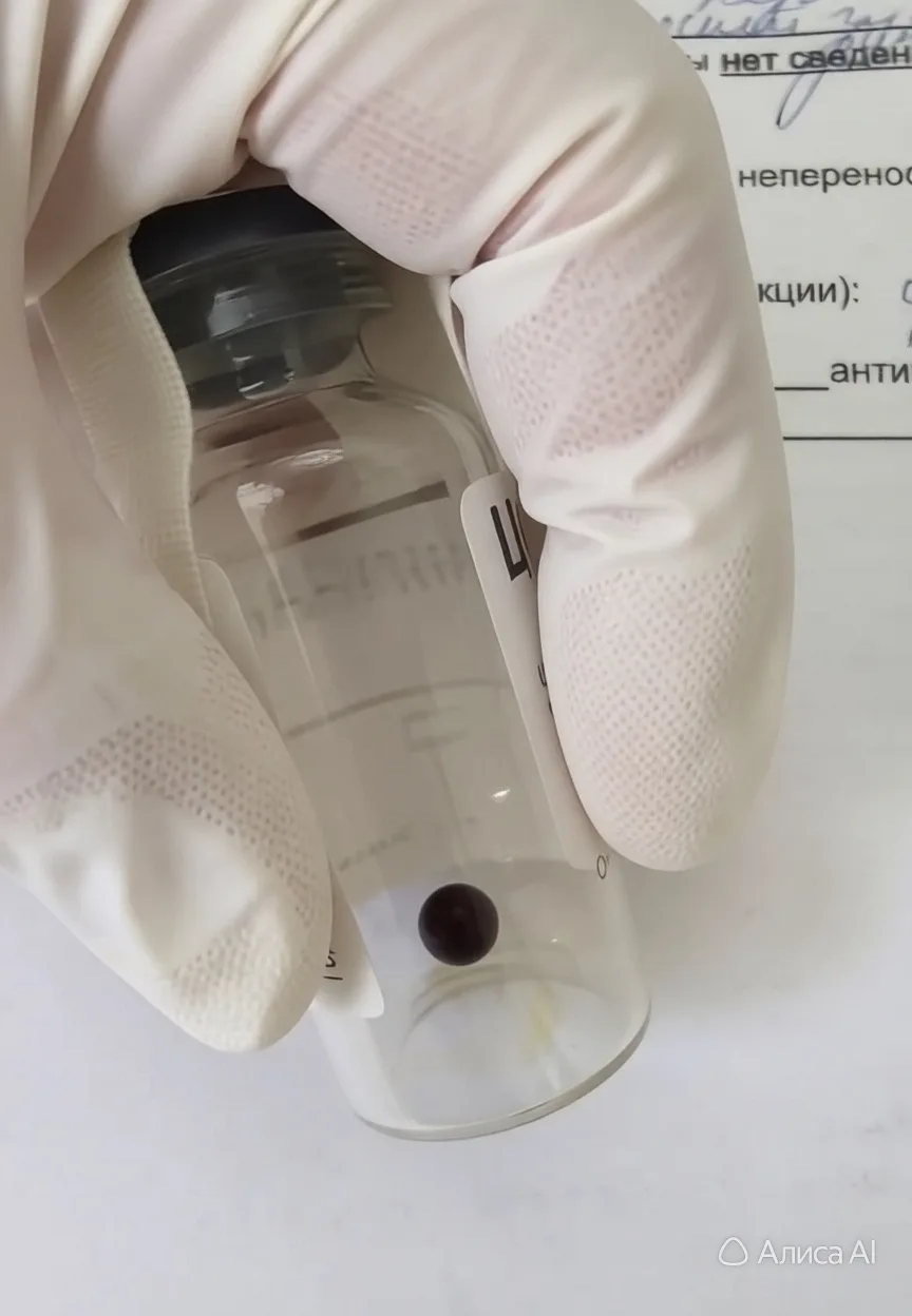 🏥 Успешная операция в Вологодской областной офтальмологической больнице: врачи извлекли инородное т