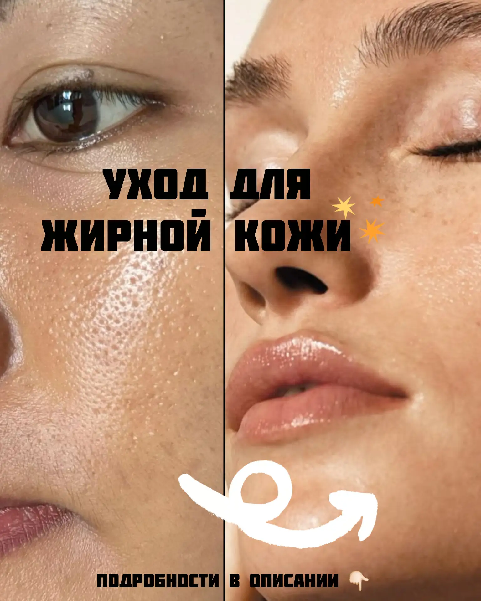Страдаешь от жирного блеска и высыпаний? 💔 Мы знаем, как помочь!