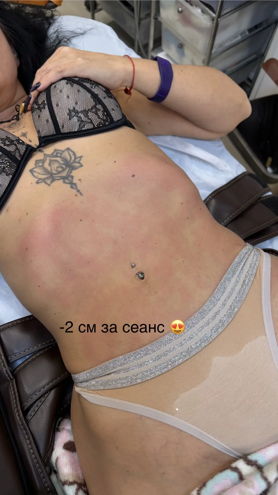 Аппарат «Импульс» 🔥🔥🔥
