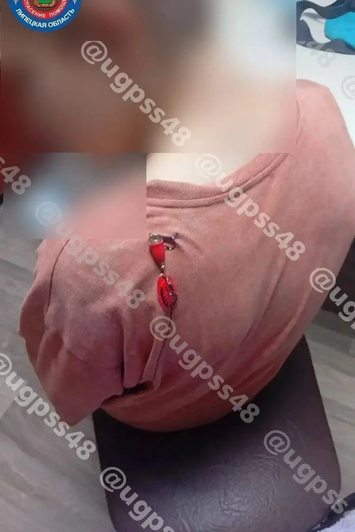 Двое подростков пострадали из-за рыболовных крючков