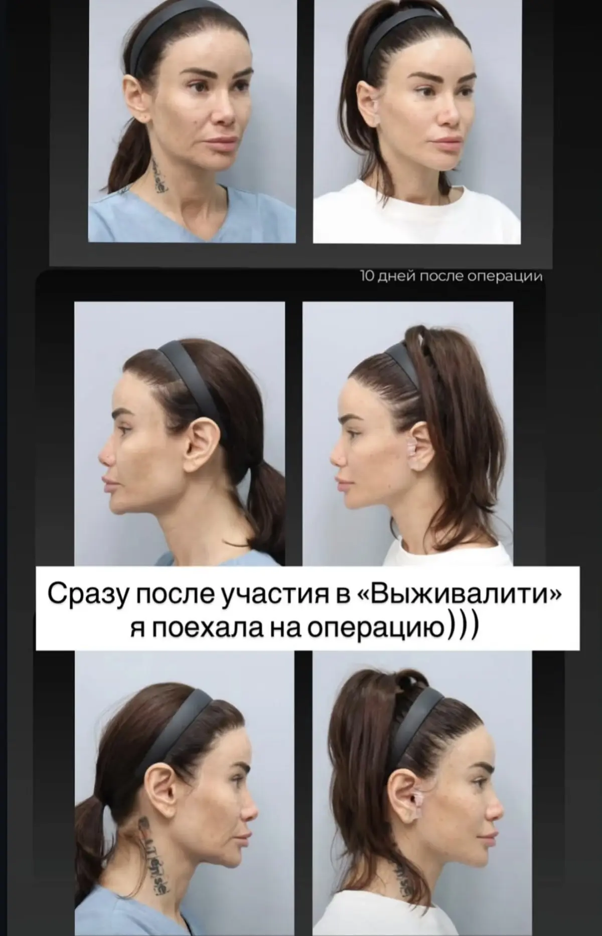 Мозг пересаживать?