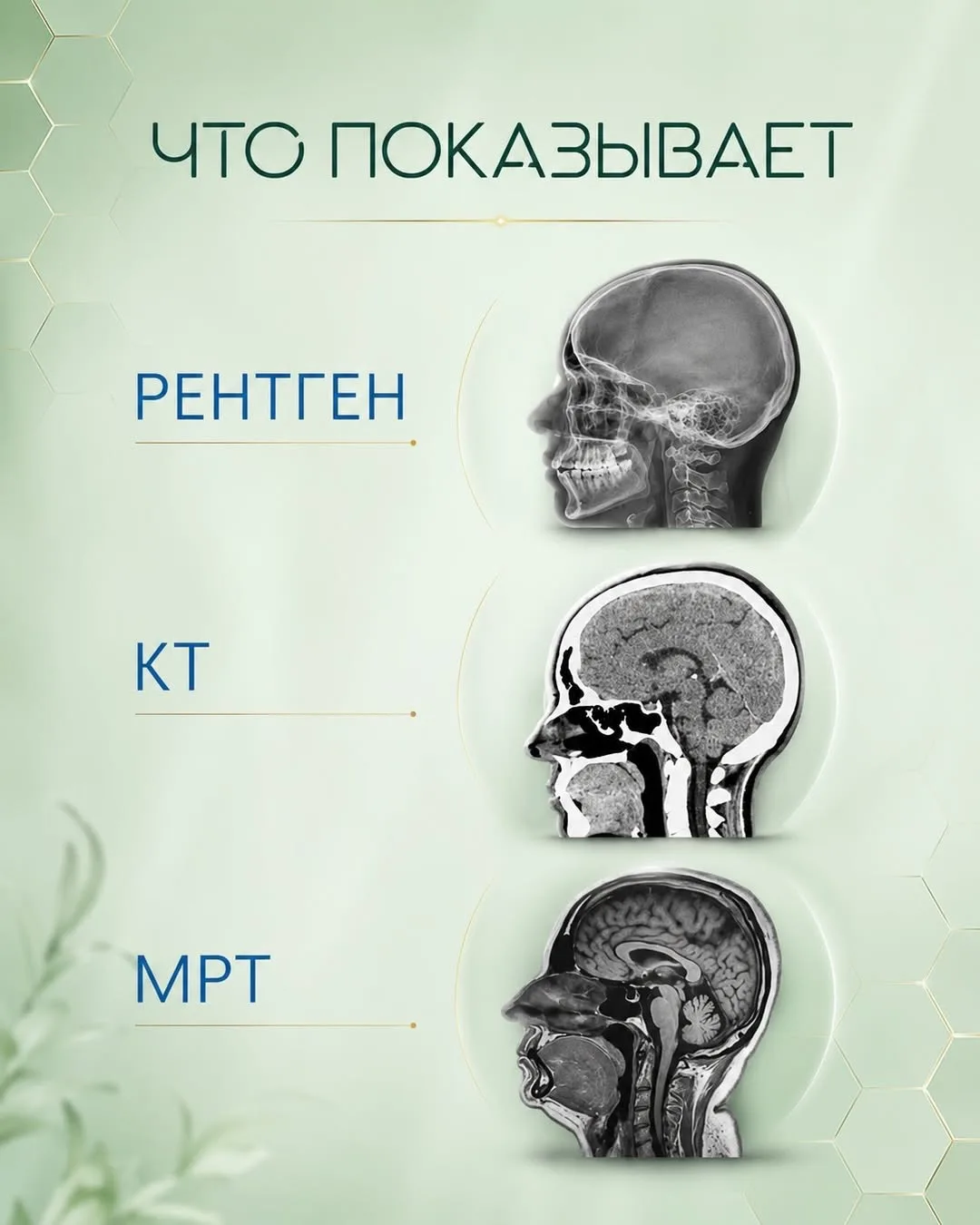 Подписывайся здесь
«Врачи Про здоровье»👩‍⚕️🏥👨‍⚕️