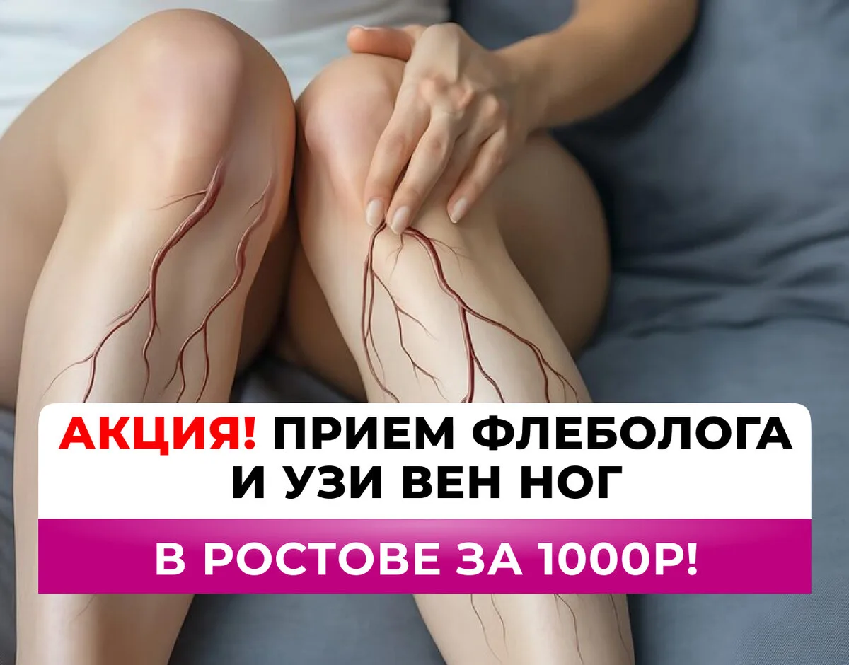 Лечение варикоза лазером:быстро, без разрезов, не больно