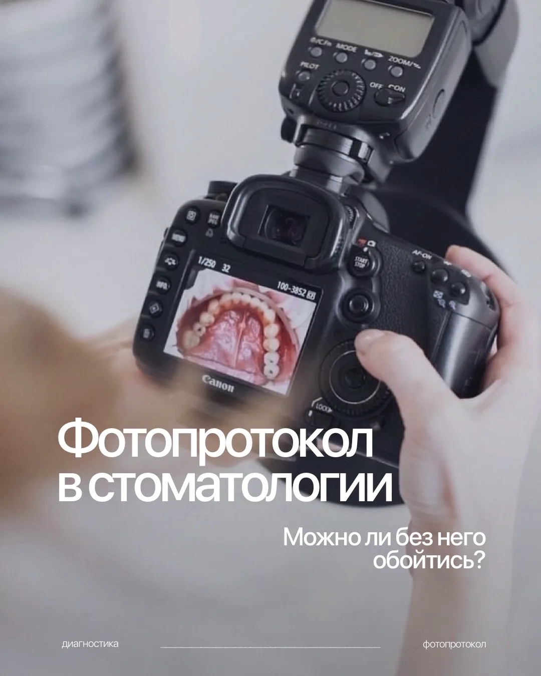 Что такое фотопротокол и зачем стоматологи фотографируют зубы?

✔️Фотопротокол в стоматологии исполь