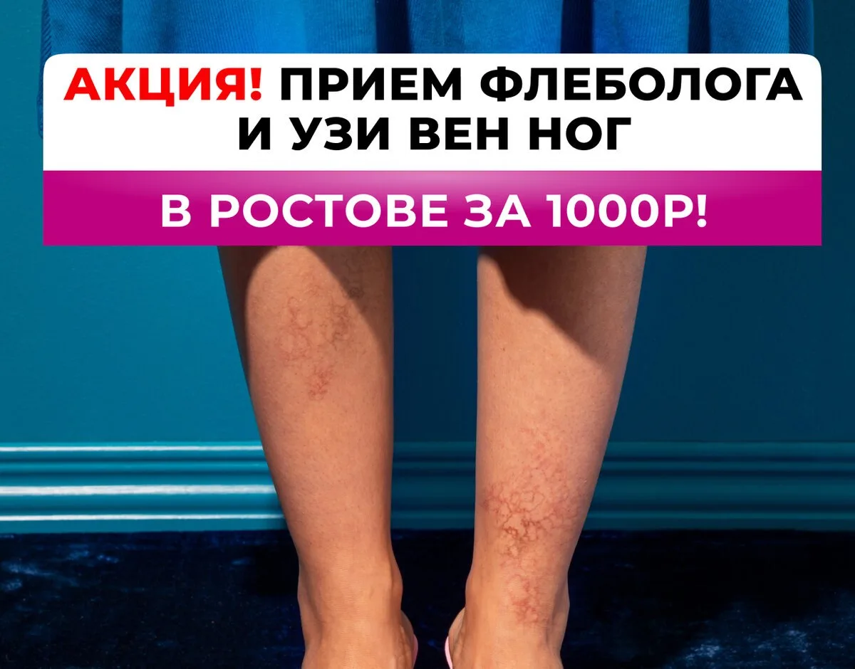 Избавляем от варикоза за 40 минут. Прием + УЗИ 1000 руб.