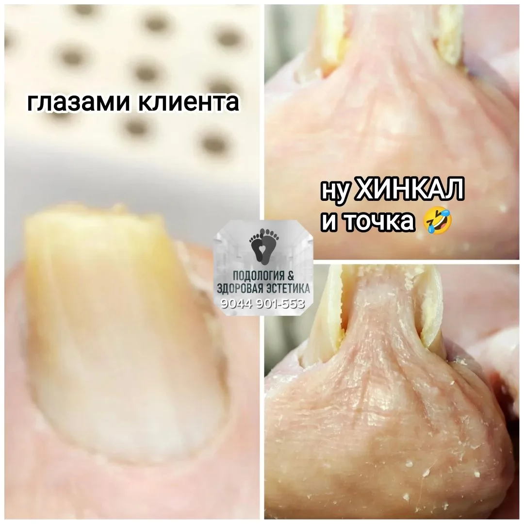 Почему я запрещаю стричь ногти дома?

Друзья, у меня для вас новый термин — «хинкал». Это не про кух
