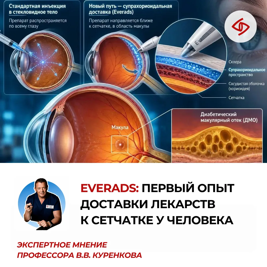 👁️ Будущее лечения заболеваний сетчатки — не только в новых препаратах, но и в том, на...