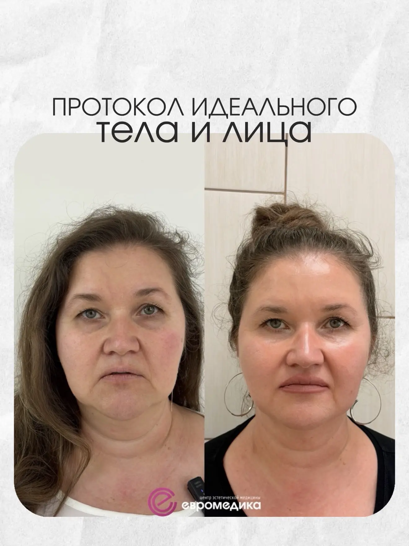 Современная эстетическая медицина — это не про отдельные процедуры, а про систему🖇️