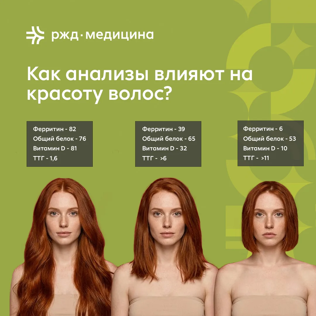✨ Красота волос начинается не с ухода, а со здоровья организма