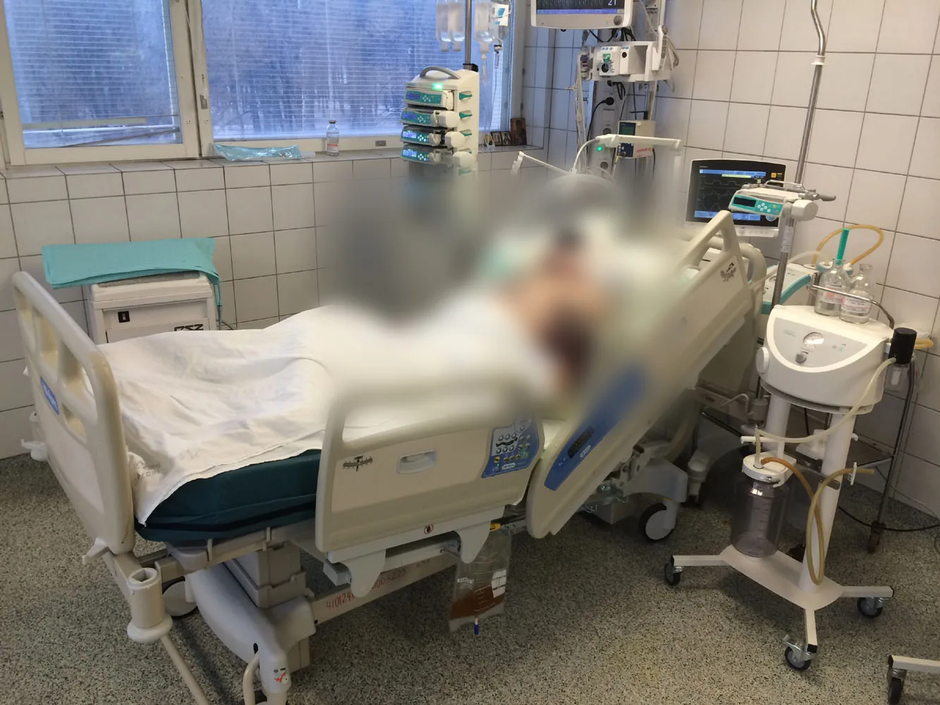 ❗️ В Красноармейском районе скончался третий пострадавший от атаки БПЛА.