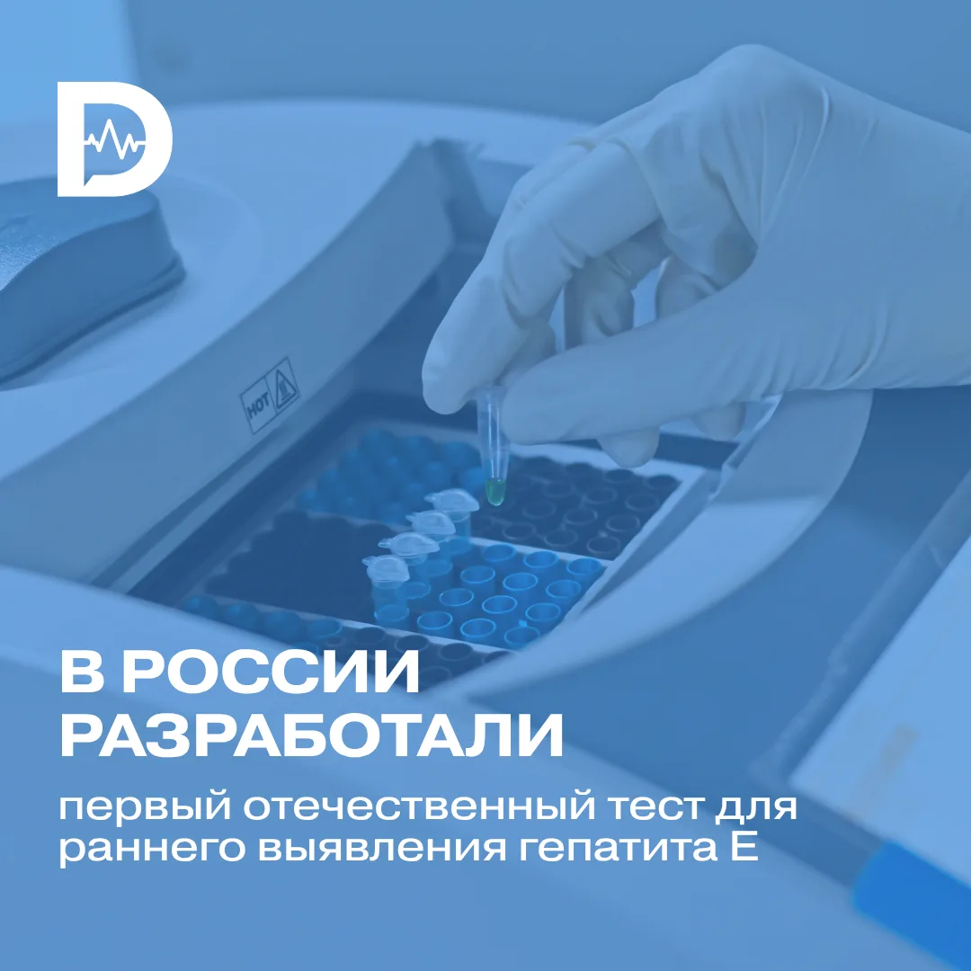 В России разработали первый отечественный ПЦР-тест для раннего выявления гепатита Е