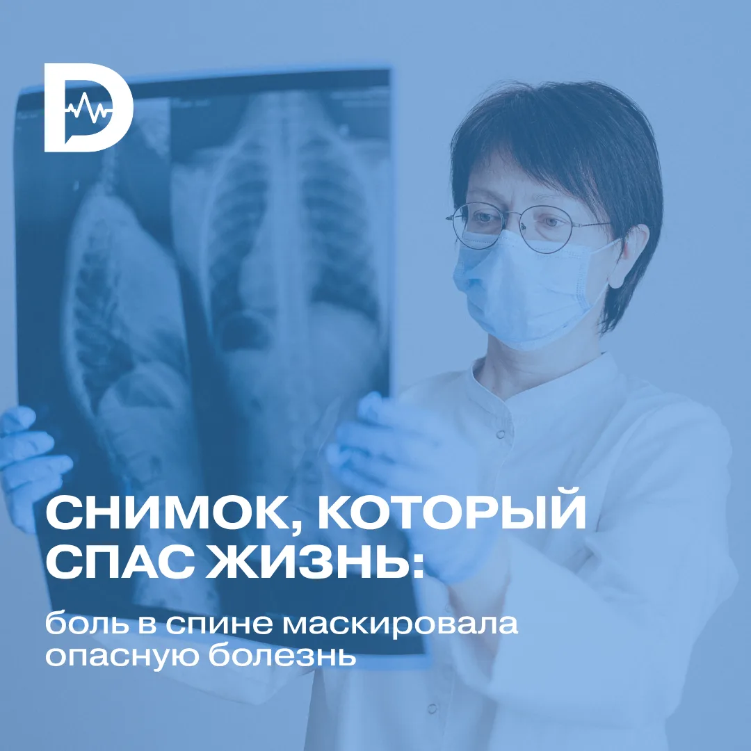 А вот ещё один случай, когда боль в спине оказалась куда серьёзней, чем просто растянут...