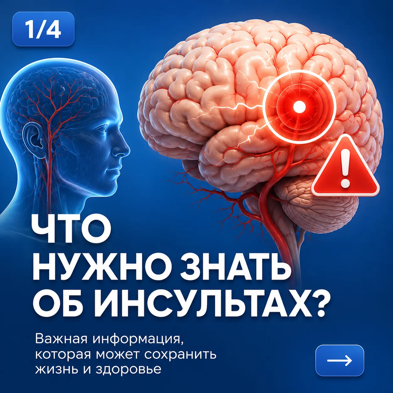 🚨 При инсульте счёт может идти на минуты. Главное — вовремя распознать признаки и дейс...