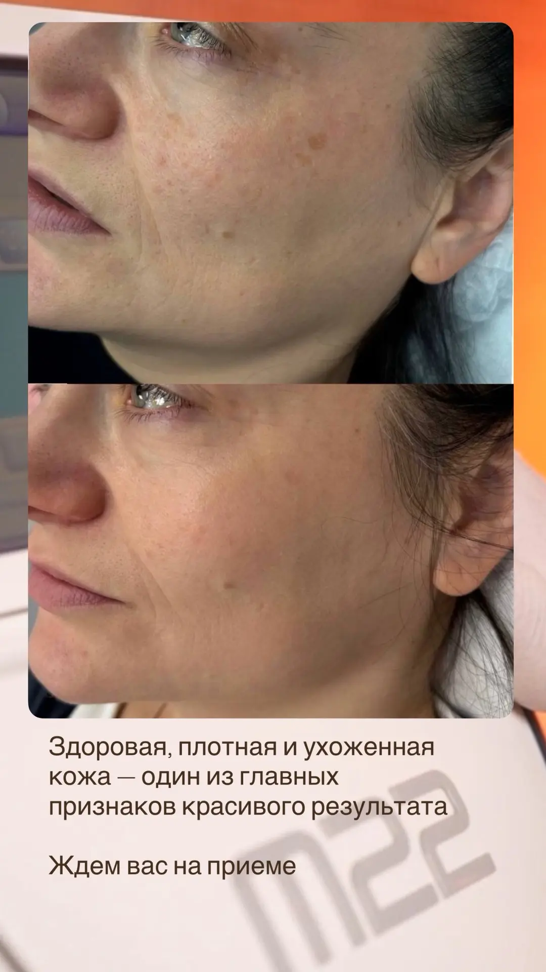 С возрастом меняется не только контур лица.