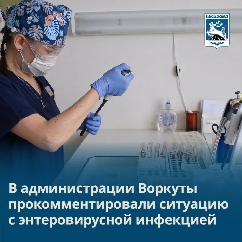 В администрации Воркуты прокомментировали ситуацию с энтеровирусной инфекцией