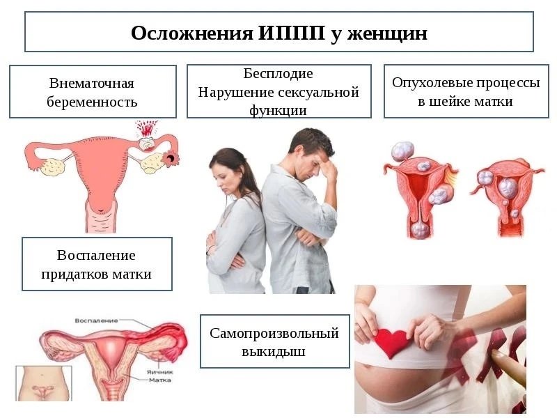 Опасность инфекций, передающихся половым путем для женщин.