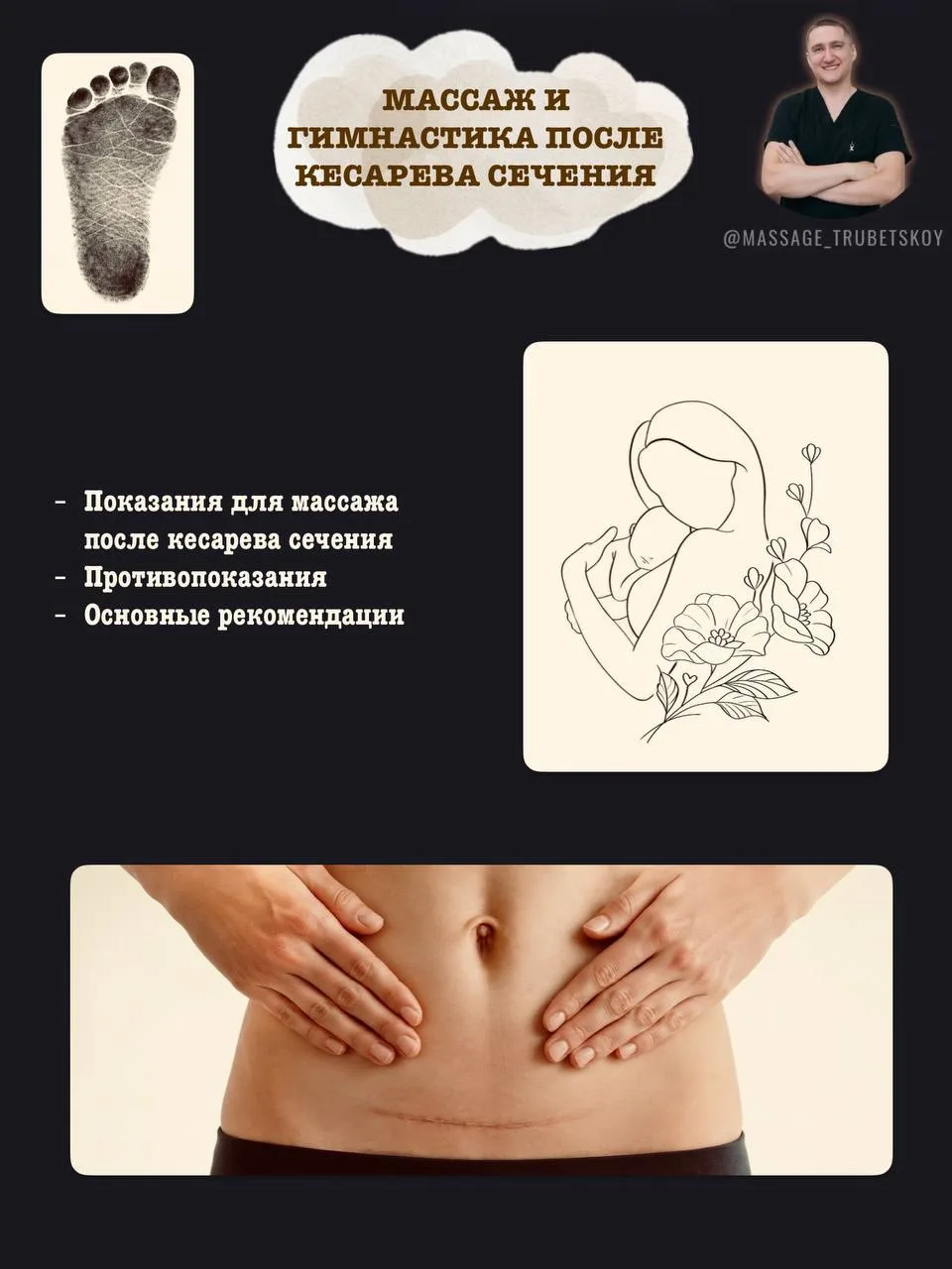 🤱🏼 Массаж и гимнастика после кесарева сечения: путь к восстановлению
