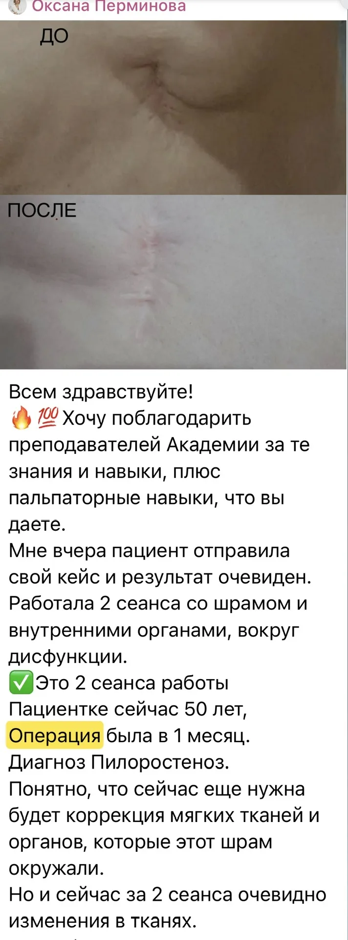 Если орган удалён — с телом уже ничего не сделать?  Но тело адаптируется. После операции ткани перес