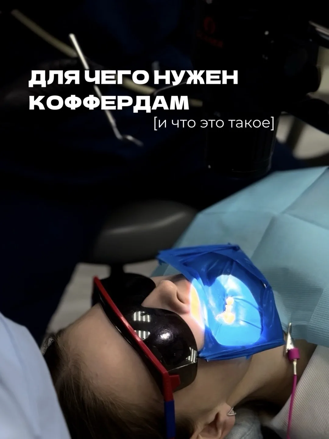 Наверняка вы замечали на приёме у стоматолога странную синюю «плёнку» на зубах 👀 И дум...
