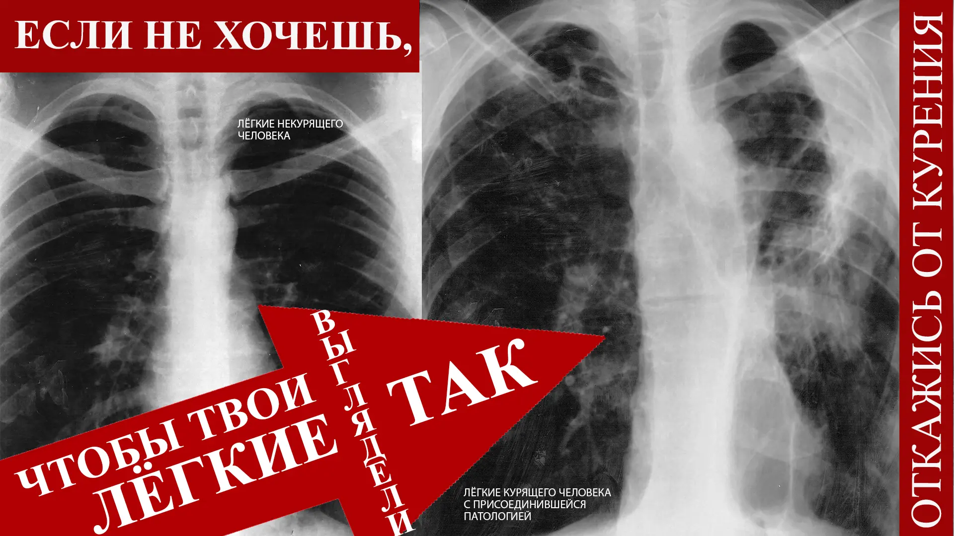 Информационные материалы по формированию профилактической среды, направленной на снижен...