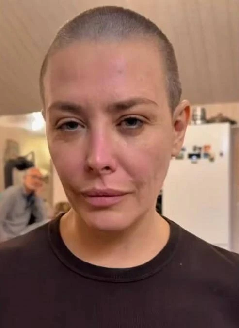Екатерина Волкова снова лысая, как 20 лет назад, когда ее побрил Эдуард Лимонов. Теперь...