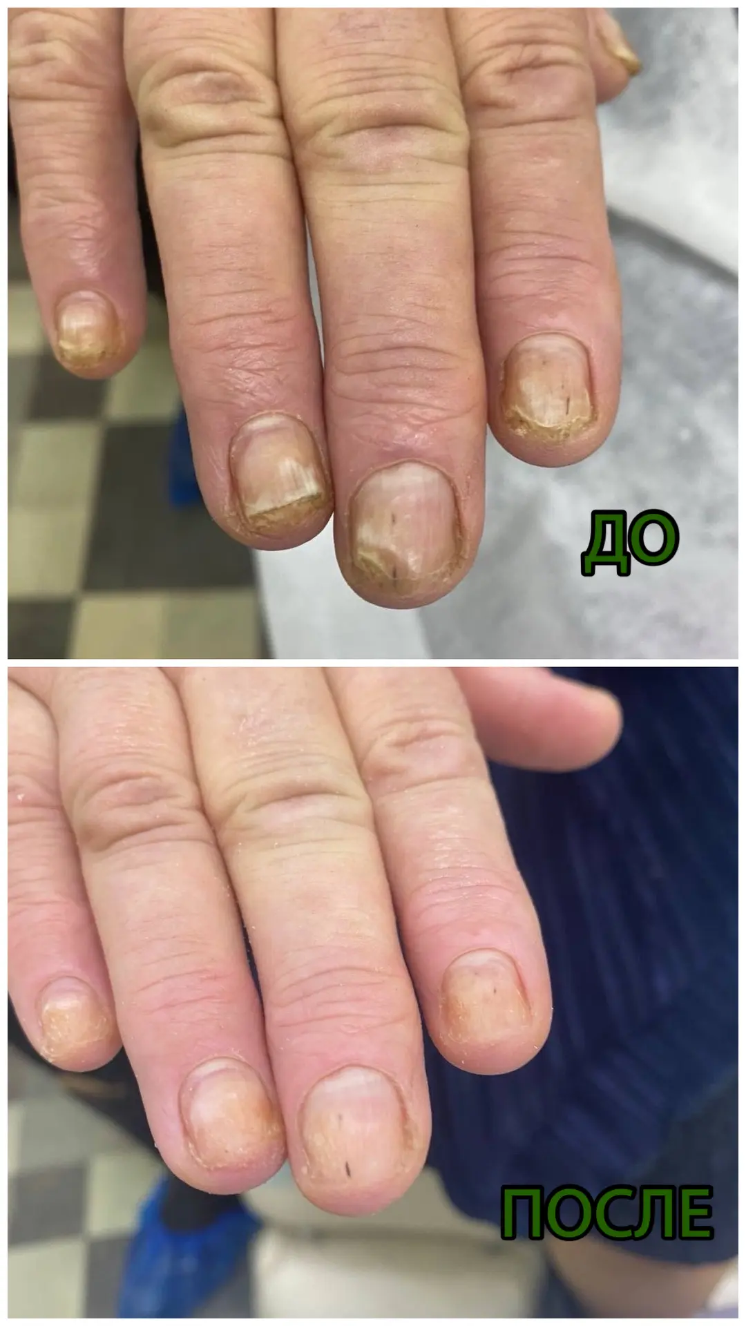 А ваши ногти готовы к лету? ☀️💅