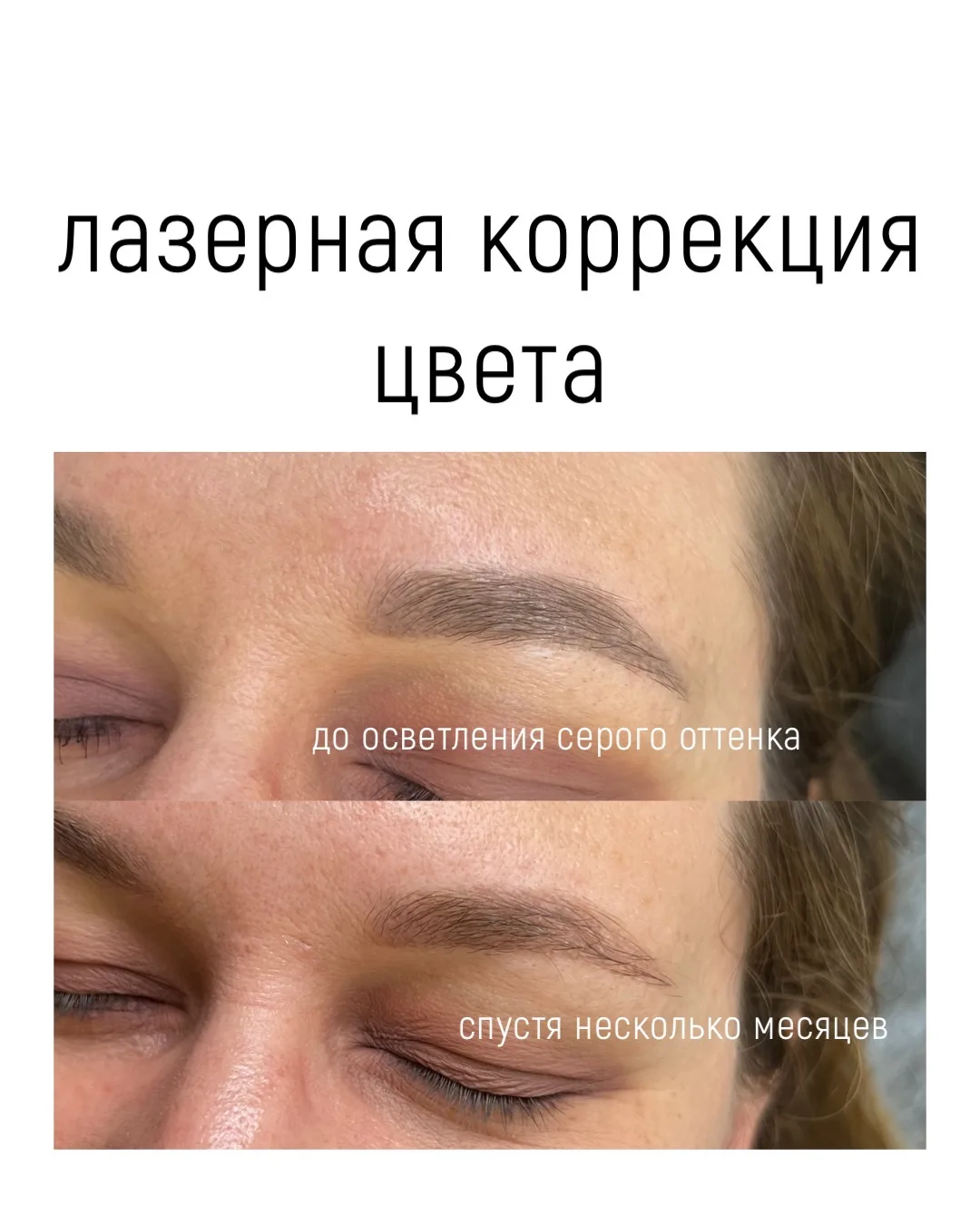 Про лазерную цветокоррекцию