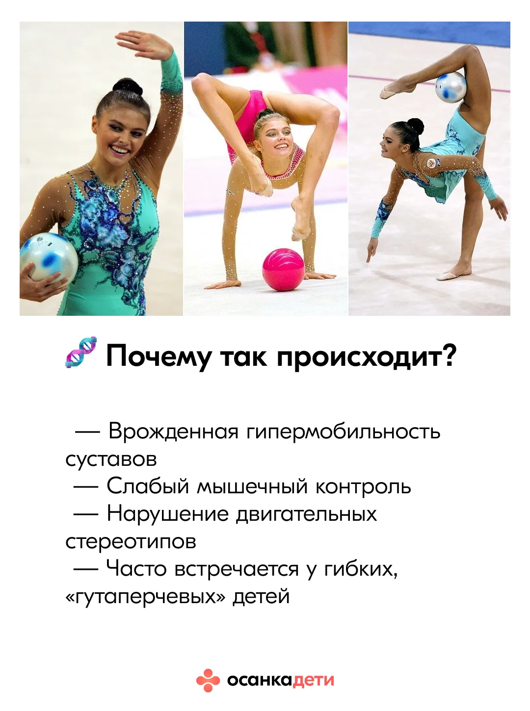 Колени-бананы 🍌 Насколько это опасно?  Переразогнутые колени у детей выглядят безобидно, и даже сейч