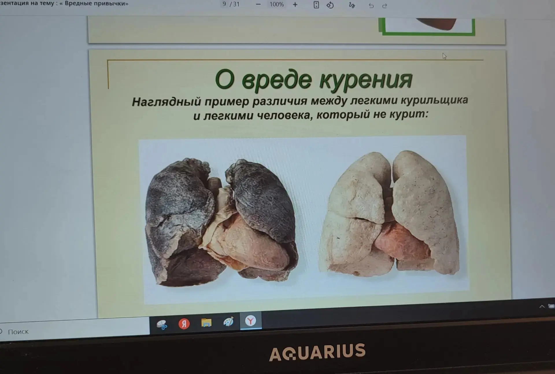 Для подростков учитель Андреева Р.И. провела профилактическую беседу о вреде курения.
В целях безопа