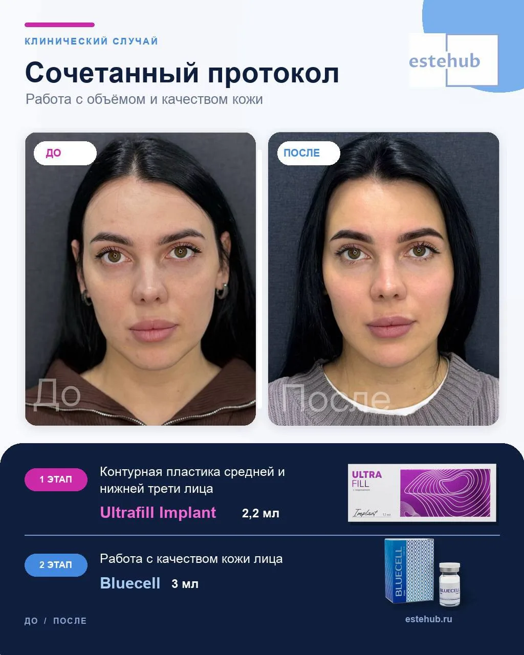Клинический случай: сочетанный протокол