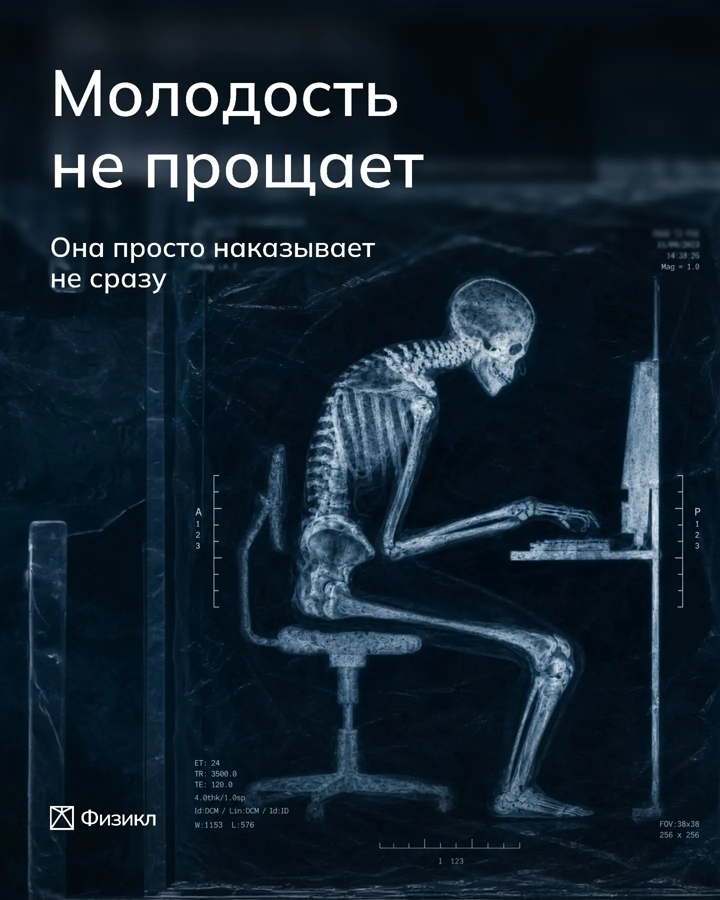 Инфаркт в 30 всё ещё редкость. Но ты стараешься.