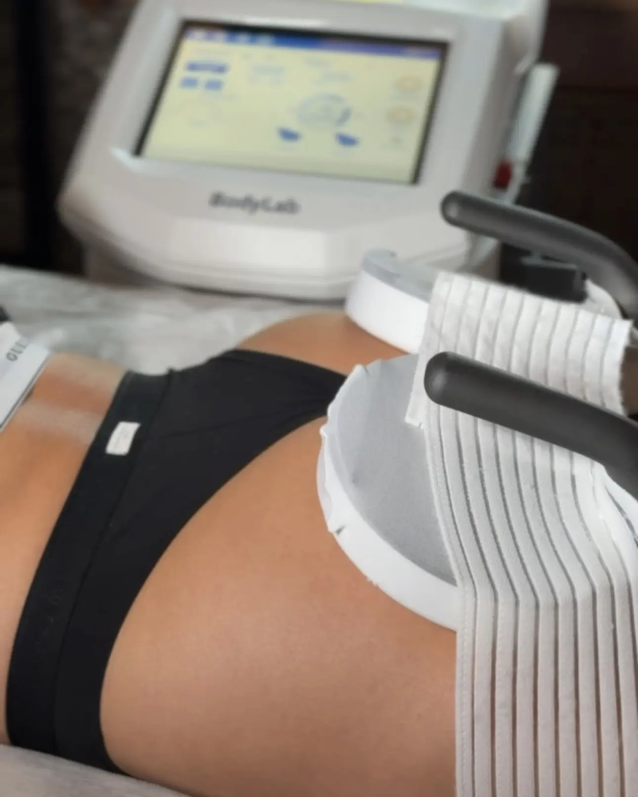 BodyLab® – технология скульптурирования тела на основе сфокусированной магнитной стимул...