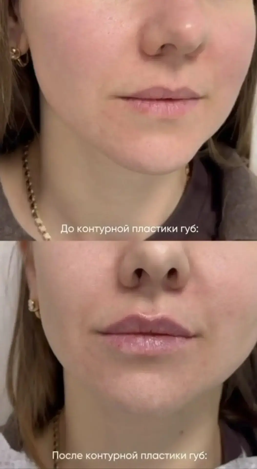 ✨ Знакомство с врачом — со скидкой 10%