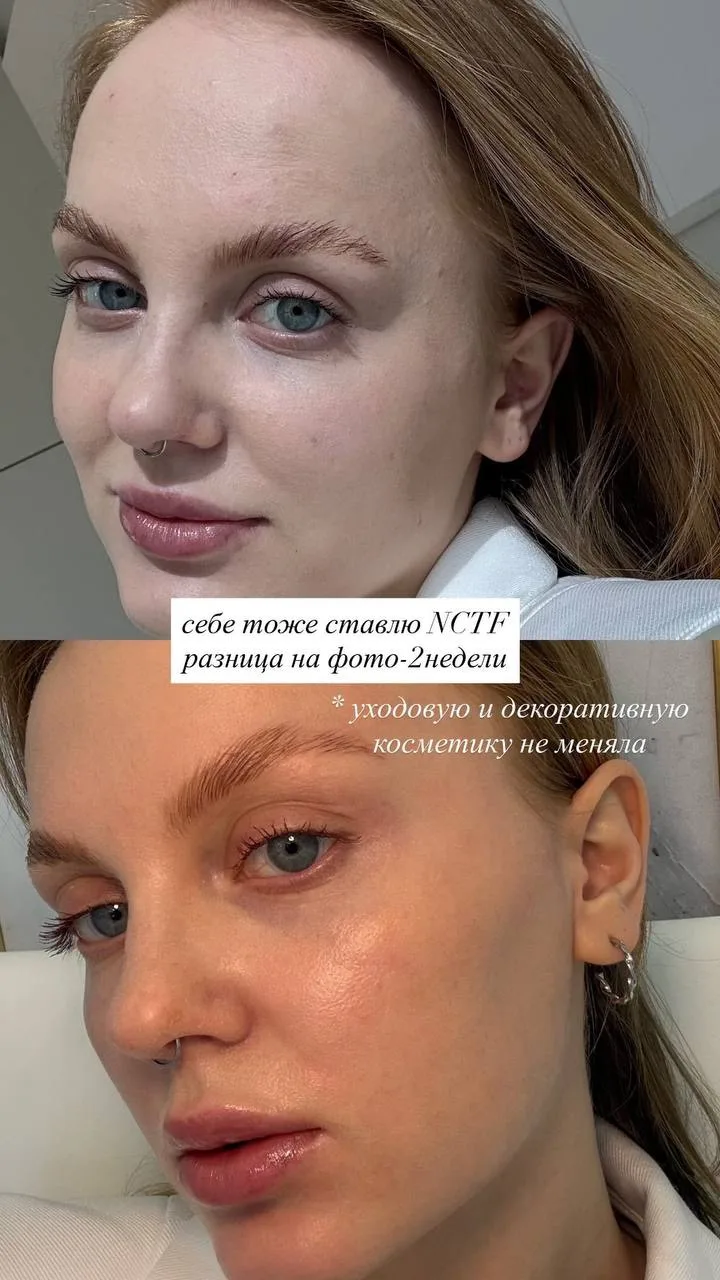 Лучший показатель, что процедуры работают - если их делает себе сам косметолог 🙏🏽