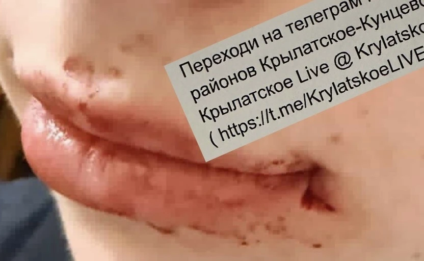 Мужчина на моноколесе ударил молодого человека по лицу около метро Крылатское и уехал 👊  У молодого 