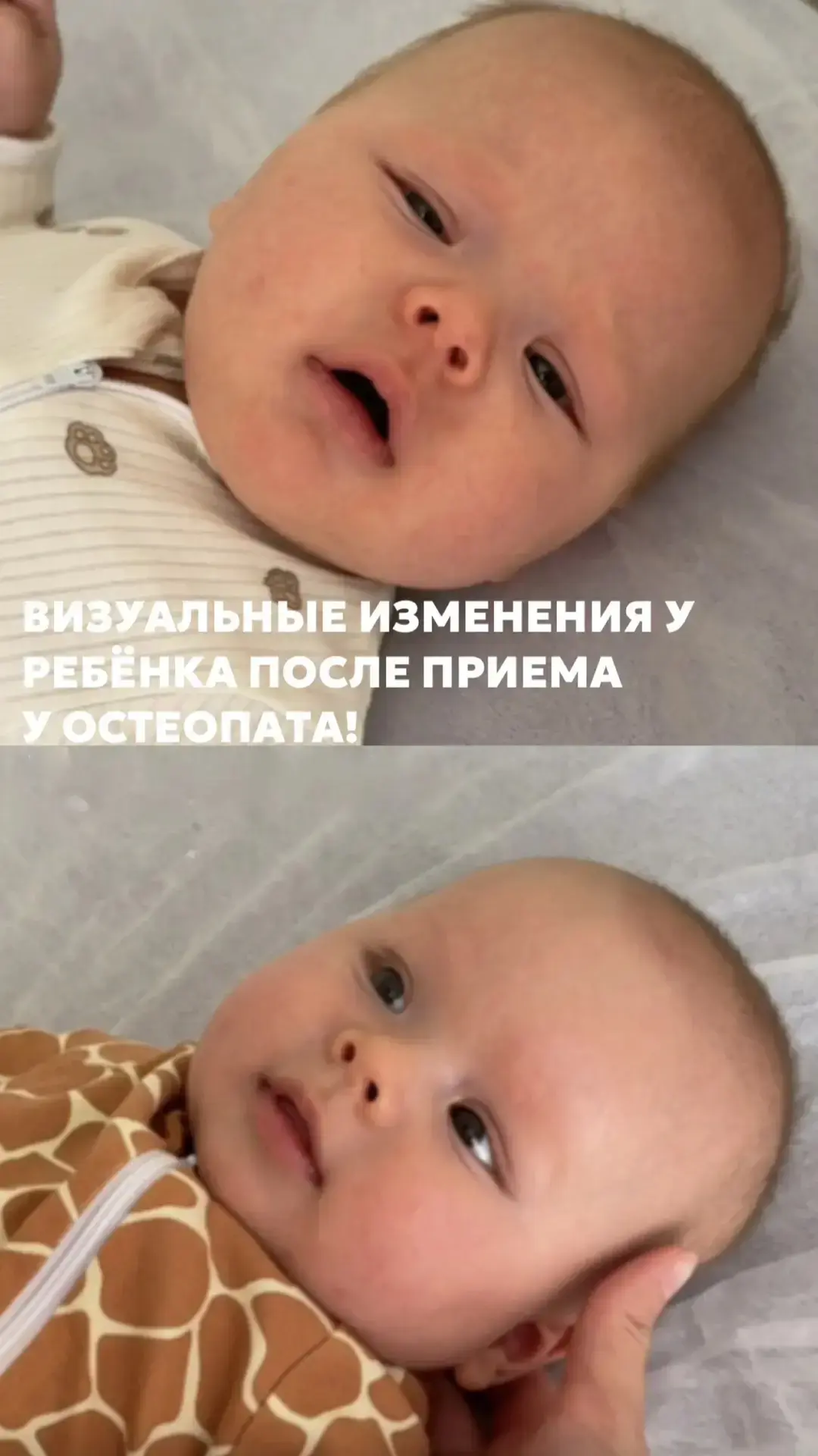 Изменения, которые вы могли не заметить после приёма остеопата