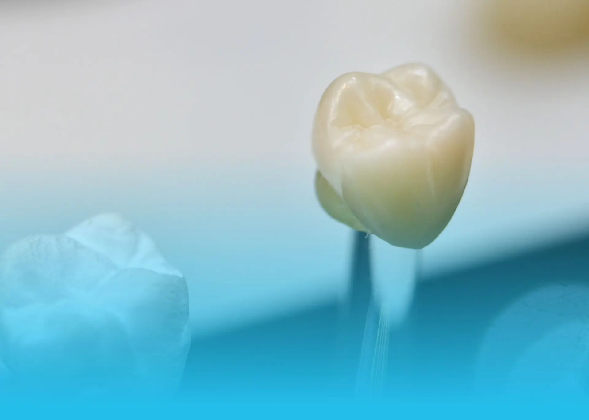 🦷 Какую коронку выбрать: металлокерамику или цирконий?