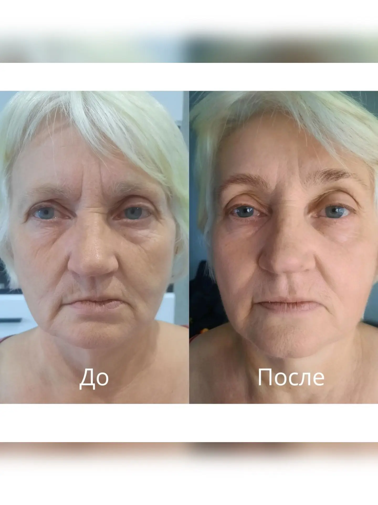 🔥 Результаты участниц прошлых потоков онлайн-марафона «Красота в балансе»