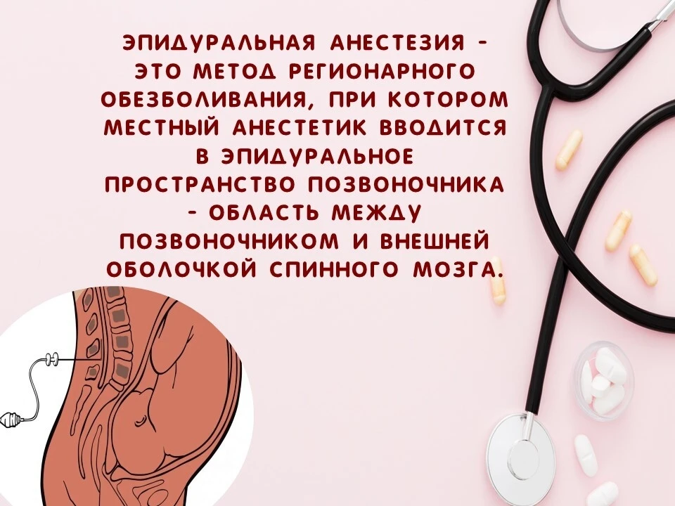 💊Что нужно знать об эпидуральной анестезии до поступления в роддом?