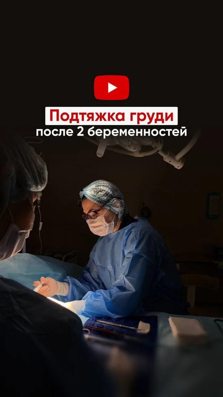 Подтяжка груди после 2х беременностей 🌺
⠀
👩🏻‍⚕️Хирург: Лысенко Екатерина Петровна, врач маммолог-