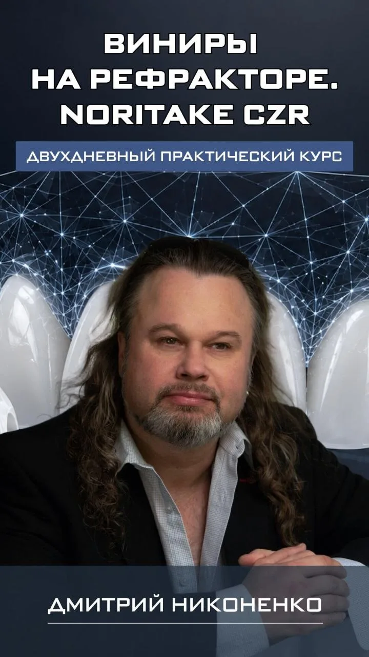 Виниры на рефракторе: от блич-оттенков до сухого блеска  ✨