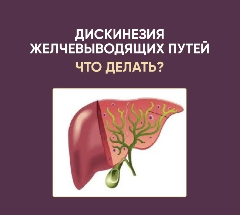 Дискинезия желчевыводящих путей (ДЖВП) - что делать при таком популярном диагнозе?