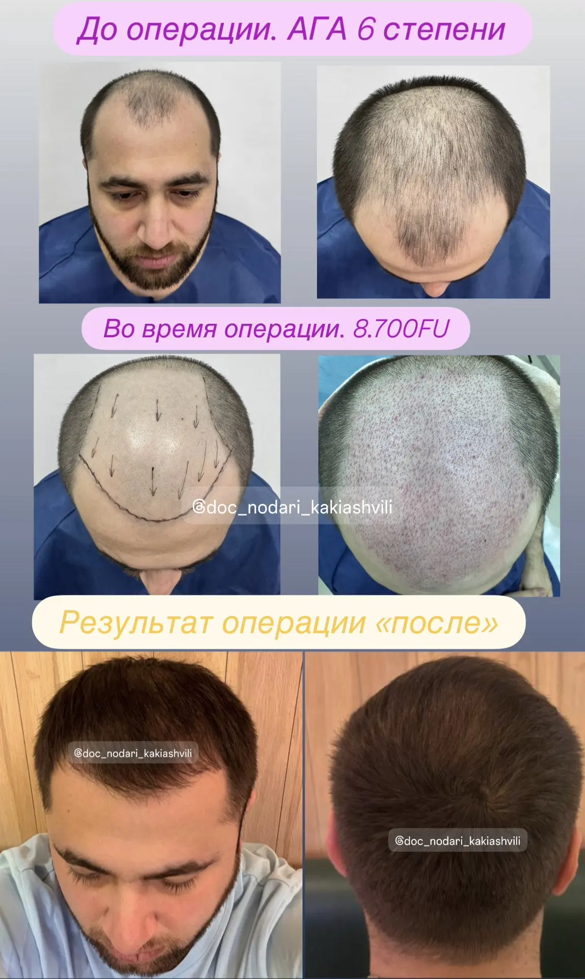 «До/после».