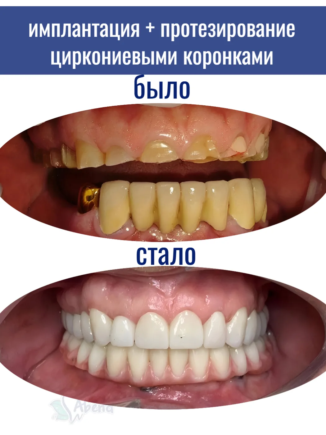 🥩 Почему желудок страдает из‑за зубов

Часто слышим от пациентов: «Доктор, ну нет одного зуба, я и 