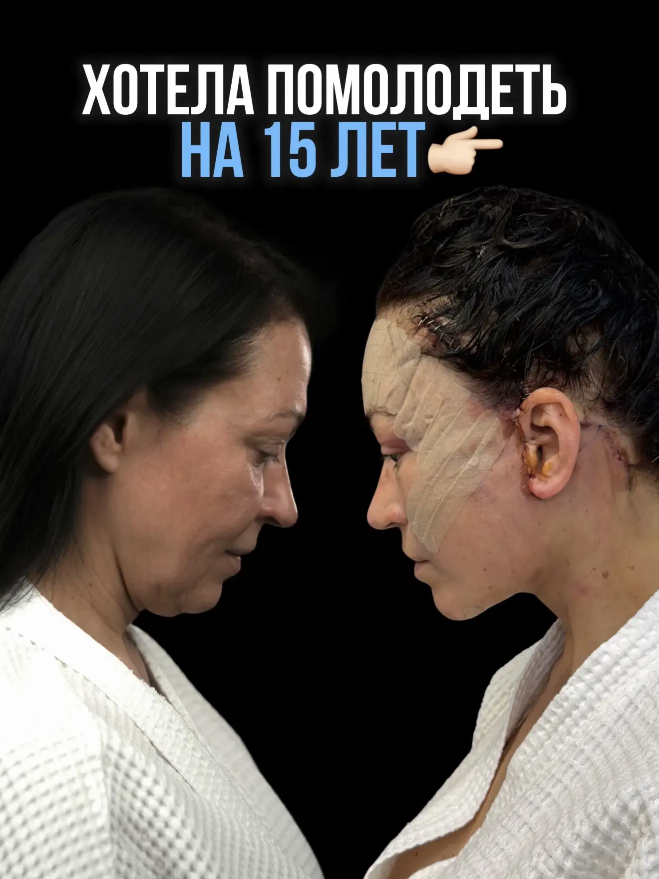 ХОТЕЛА ПОМОЛОДЕТЬ НА 15 ЛЕТ👇🏻