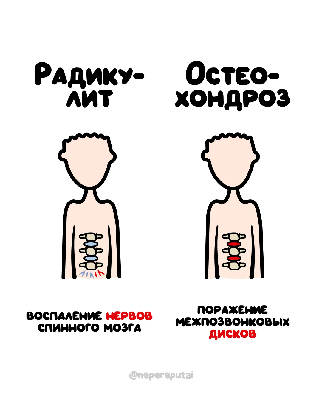 Взросление — это когда различаешь эти диагнозы не по картинкам, а по ощущениям в спине 📉

Мы в МАХ
