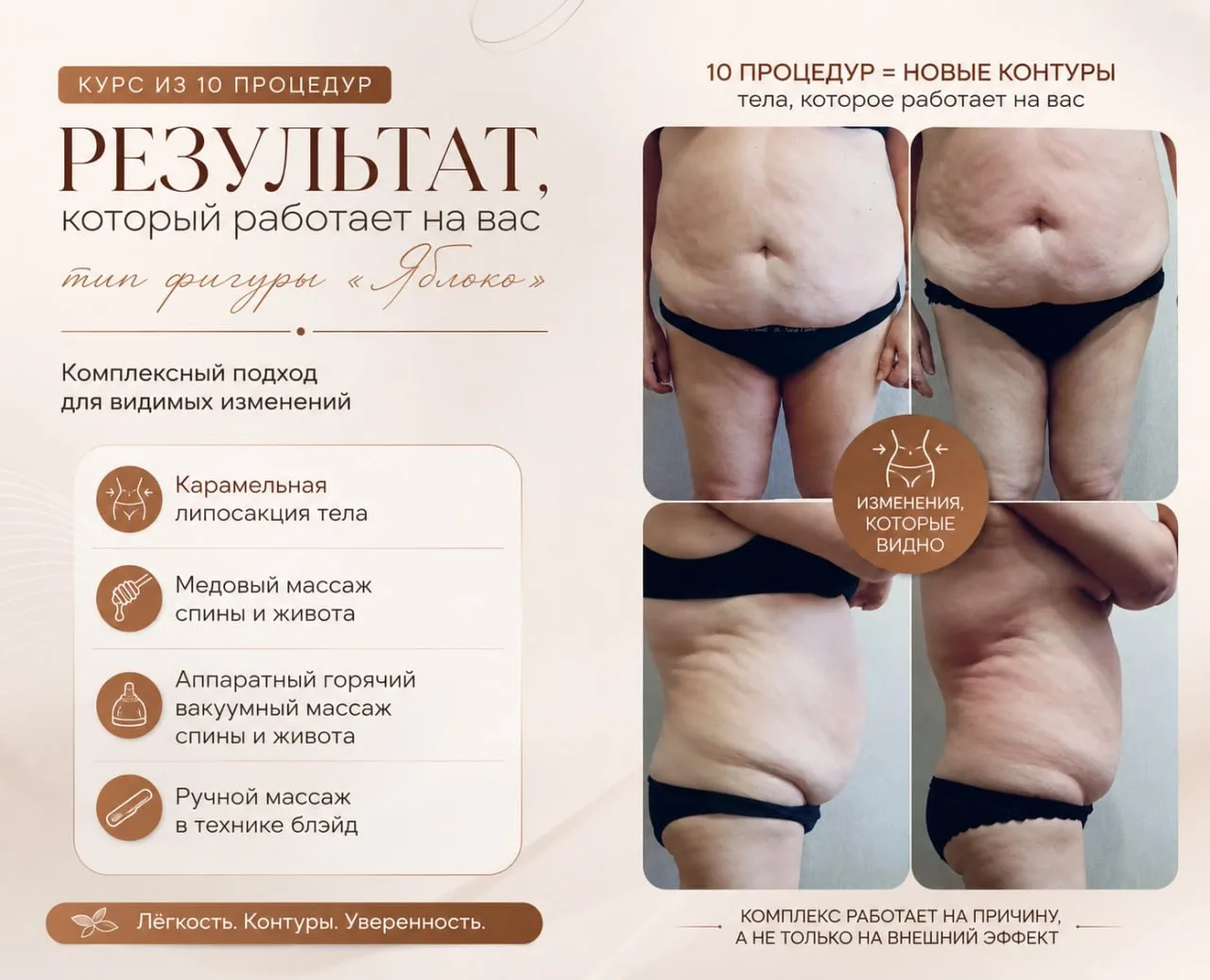На фото видно не только живот, видно, что изменился силуэт.