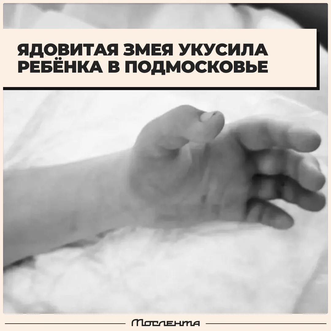 🐍 Гадюка укусила ребёнка в Подмосковье.

Девочку сразу госпитализировали, но стабилизировать её сос