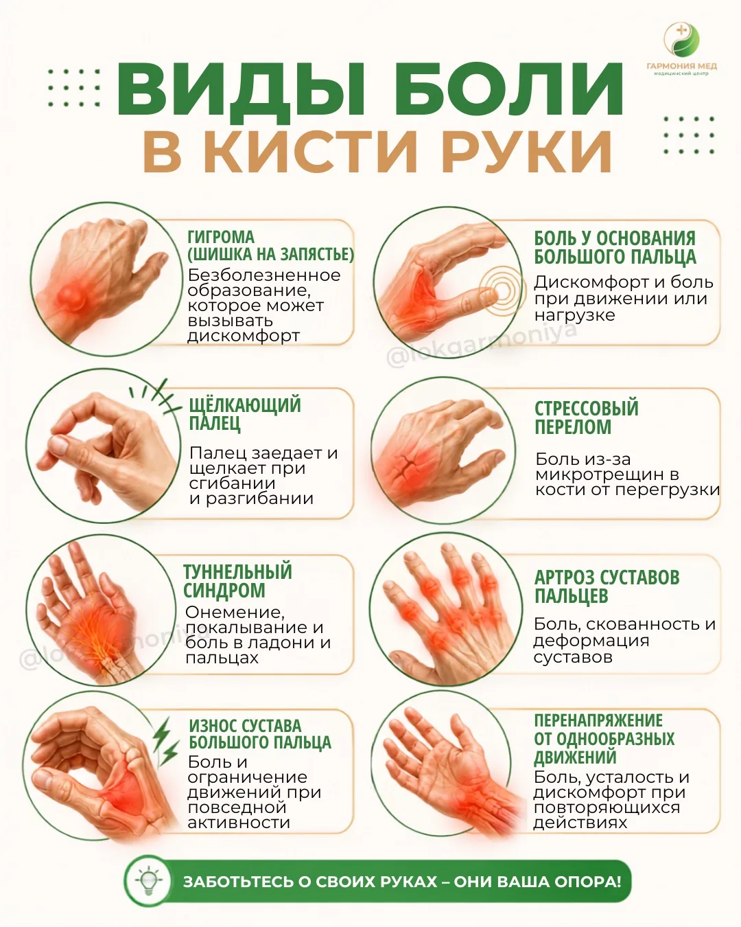 Наши руки выносят всё: от бесконечной печати до тяжелых сумок. А мы замечаем их, только когда в кист
