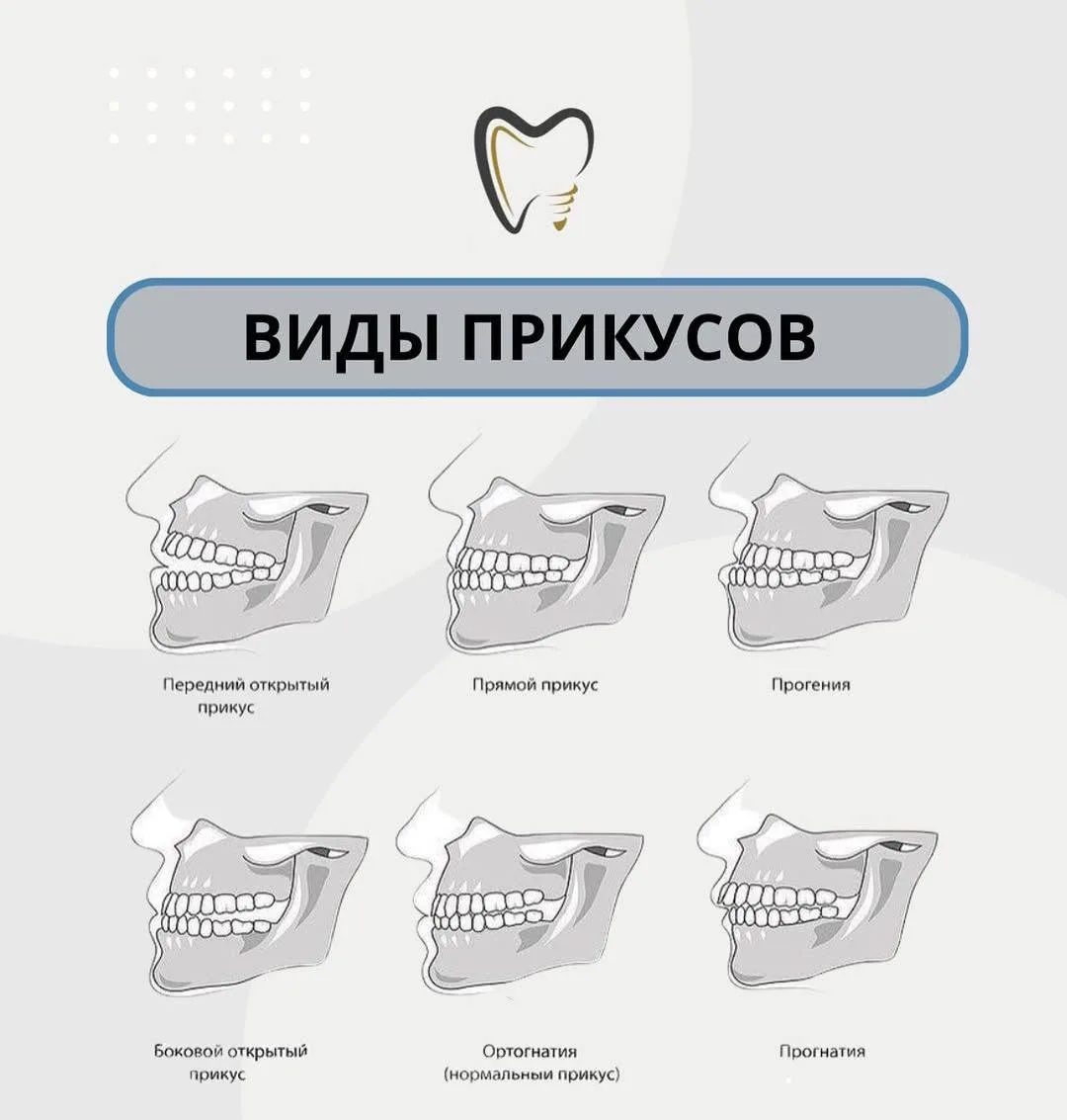 Виды прикусов.

🧐 Наука и Факты
